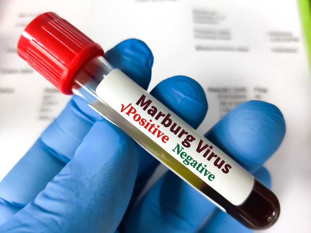 Korkunç Hastalık: Resmi olarak içeriden çürütüyor! Ebola'ya benzer virüs 8 kişinin hayatını aldı 3