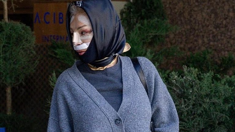 Nadia Almada Türkiye’deki operasyon sonrası görüntülendi